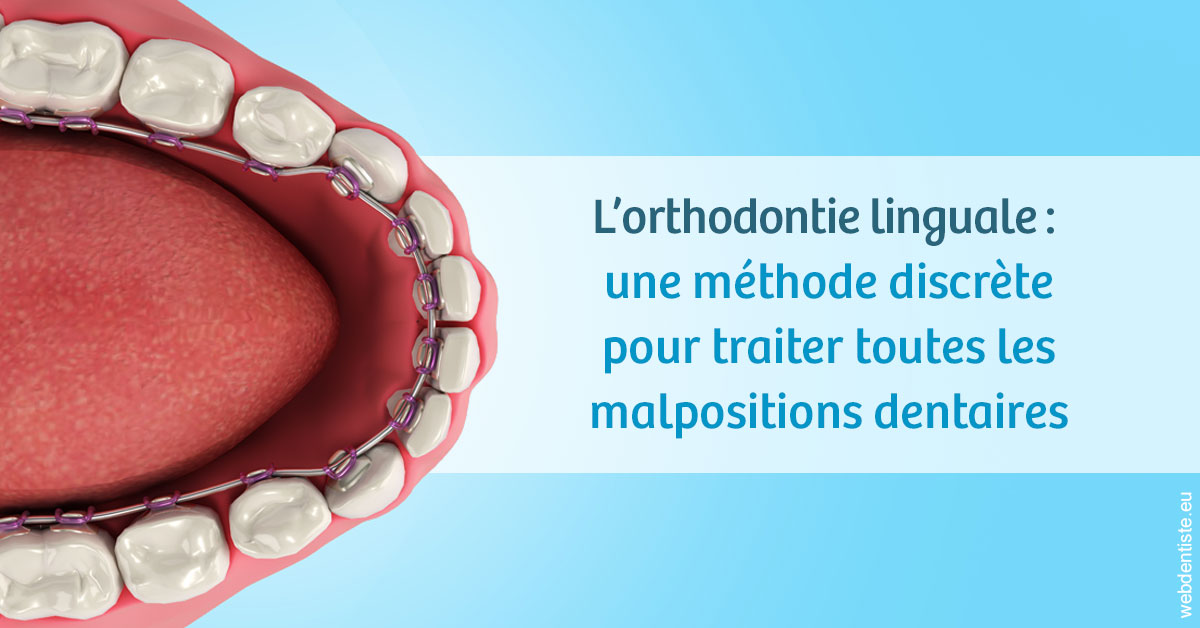 https://dr-sadoul-frederic.chirurgiens-dentistes.fr/L'orthodontie linguale 1