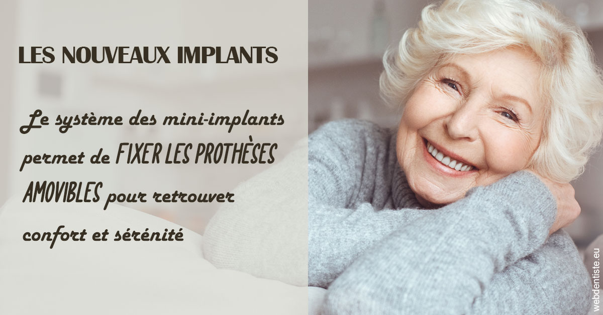 https://dr-sadoul-frederic.chirurgiens-dentistes.fr/Les nouveaux implants 1