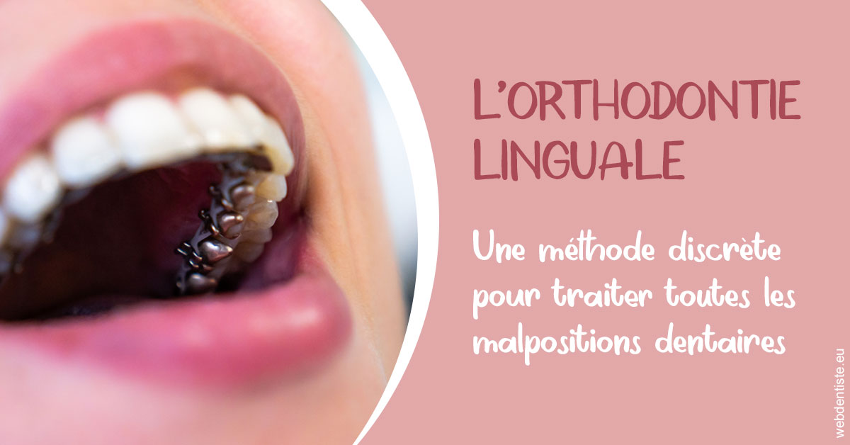 https://dr-sadoul-frederic.chirurgiens-dentistes.fr/L'orthodontie linguale 2
