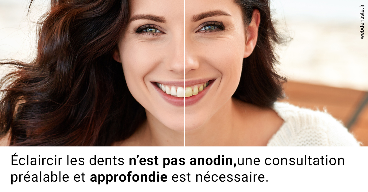 https://dr-sadoul-frederic.chirurgiens-dentistes.fr/Le blanchiment 2