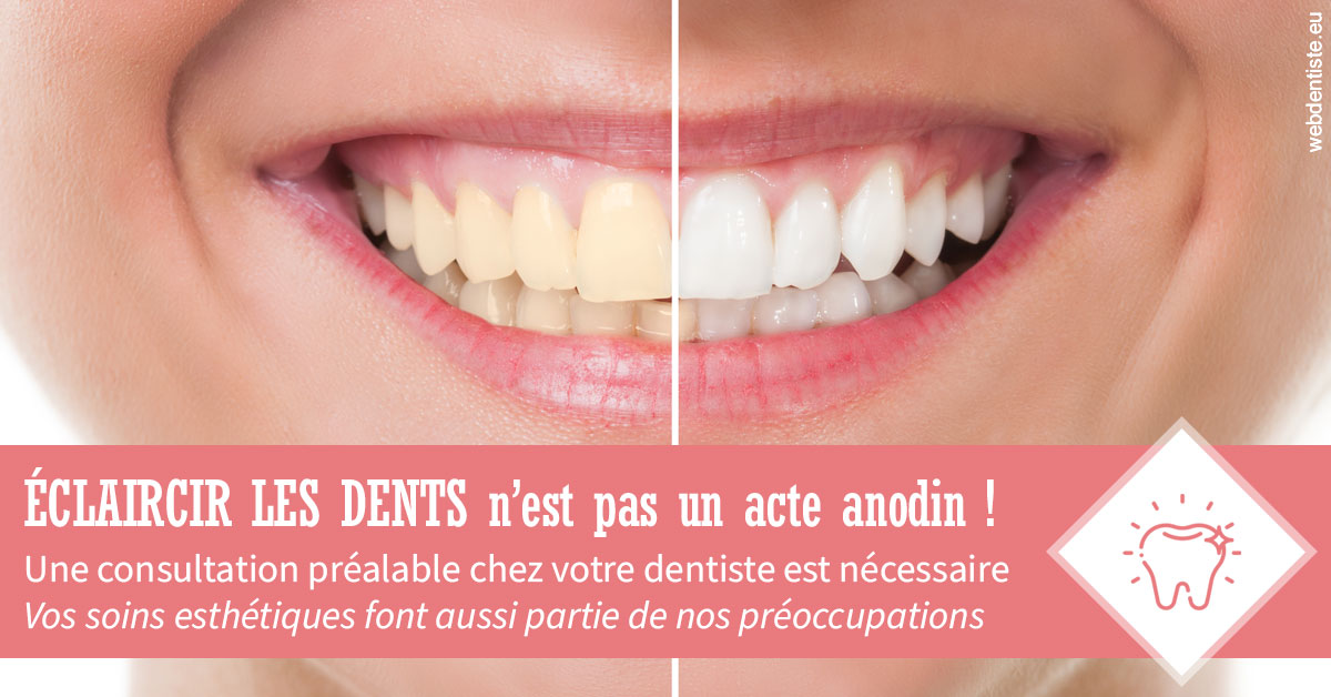 https://dr-sadoul-frederic.chirurgiens-dentistes.fr/Eclaircir les dents 1