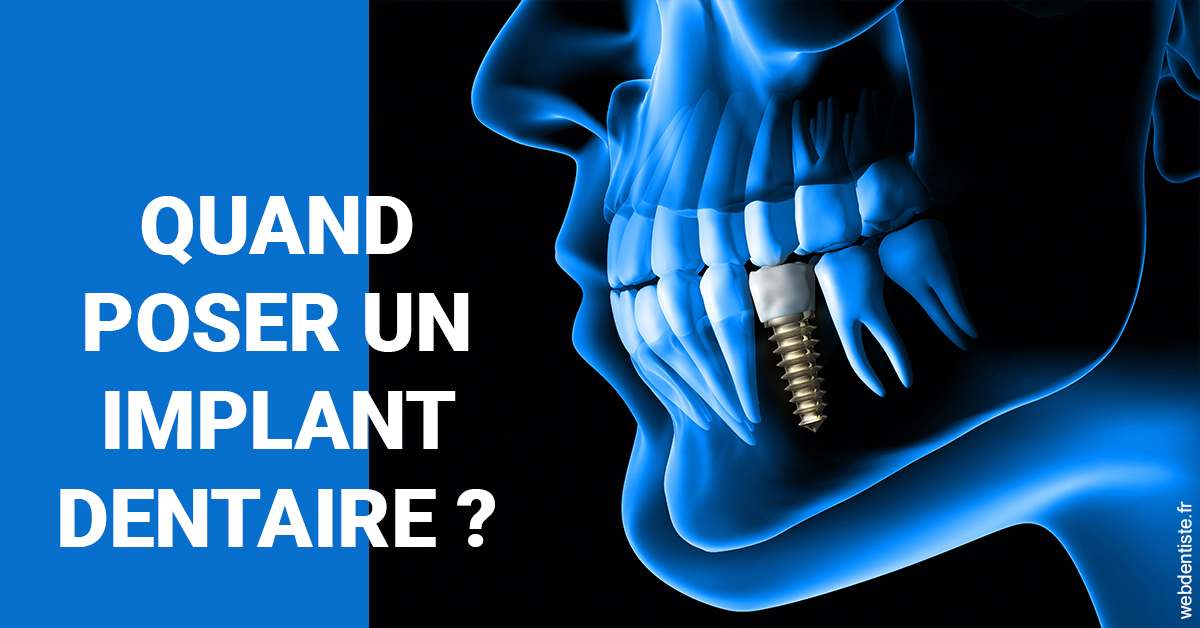 https://dr-sadoul-frederic.chirurgiens-dentistes.fr/Les implants 1