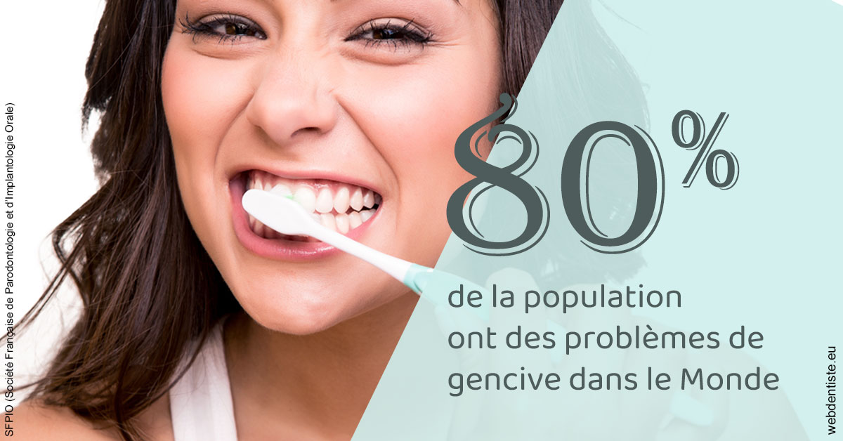 https://dr-sadoul-frederic.chirurgiens-dentistes.fr/Problèmes de gencive 1