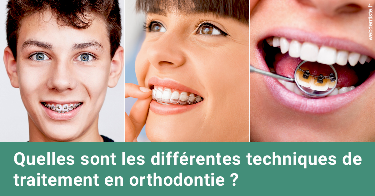 https://dr-sadoul-frederic.chirurgiens-dentistes.fr/Les différentes techniques de traitement 2
