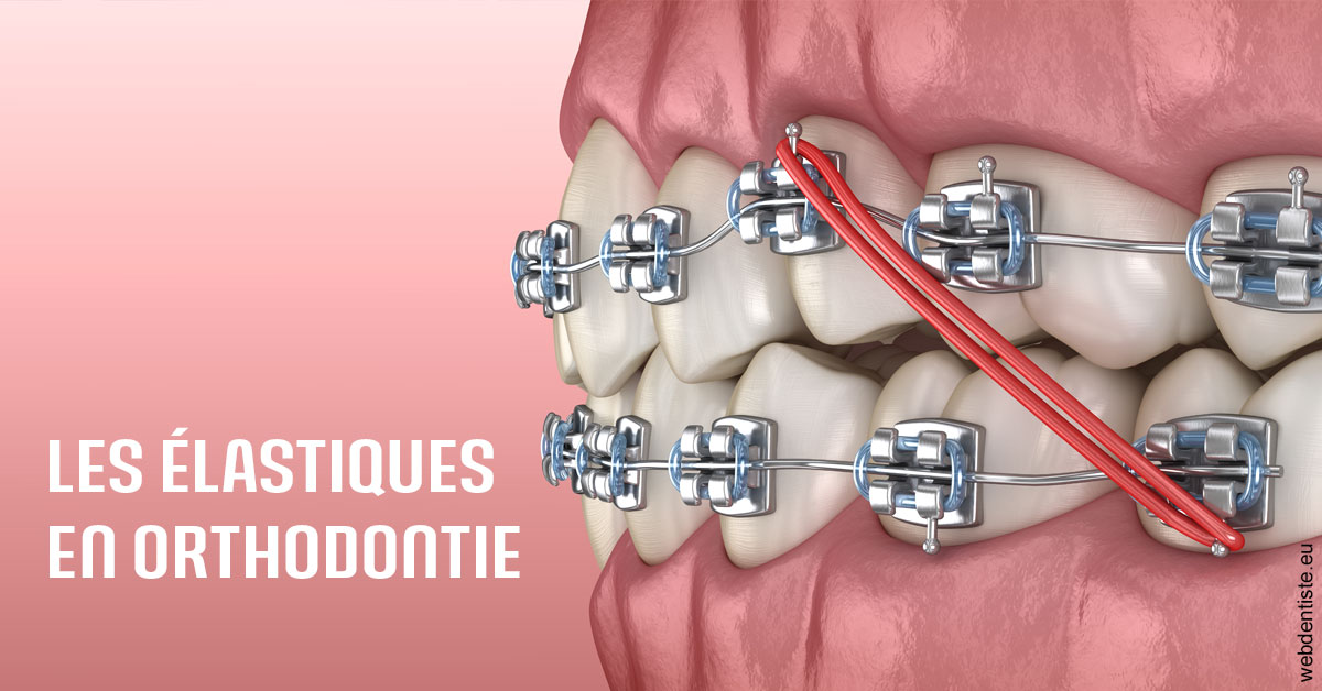 https://dr-sadoul-frederic.chirurgiens-dentistes.fr/Elastiques orthodontie 2