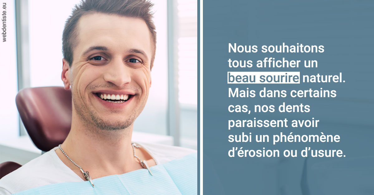 https://dr-sadoul-frederic.chirurgiens-dentistes.fr/Érosion et usure dentaire