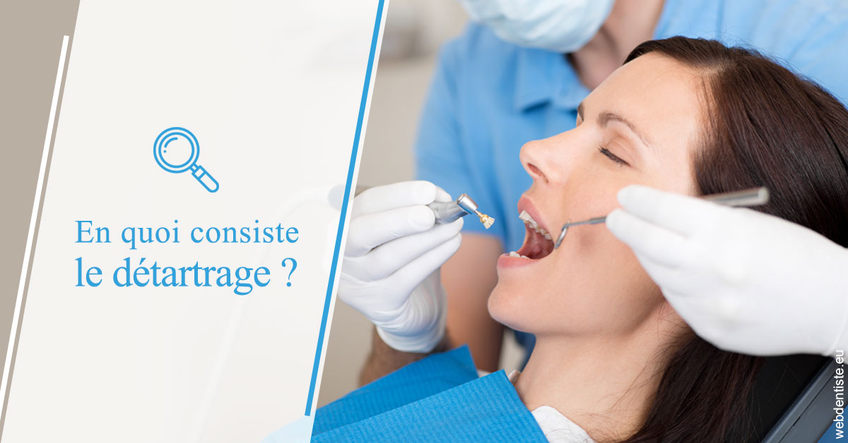 https://dr-sadoul-frederic.chirurgiens-dentistes.fr/En quoi consiste le détartrage