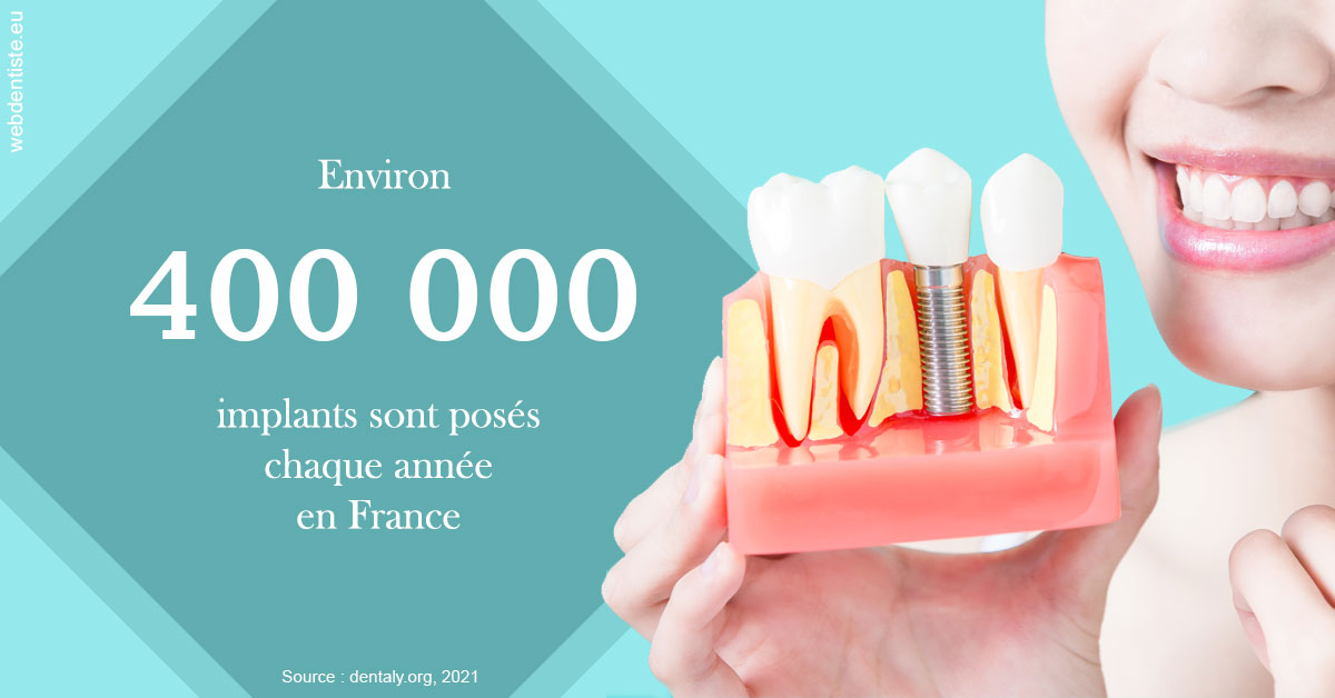 https://dr-sadoul-frederic.chirurgiens-dentistes.fr/Pose d'implants en France 2